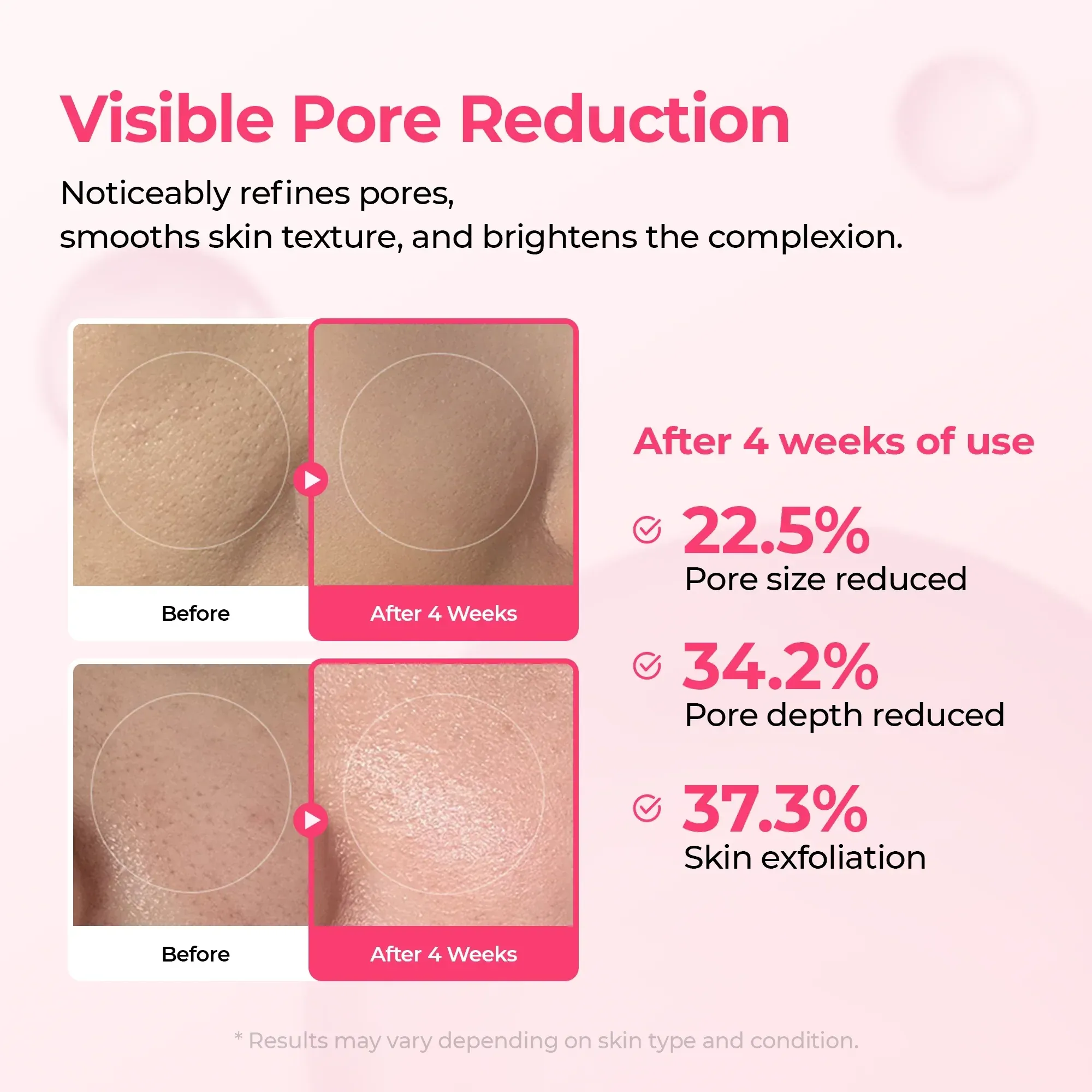 Lumi Pore & Spot Care Duo - Image 3